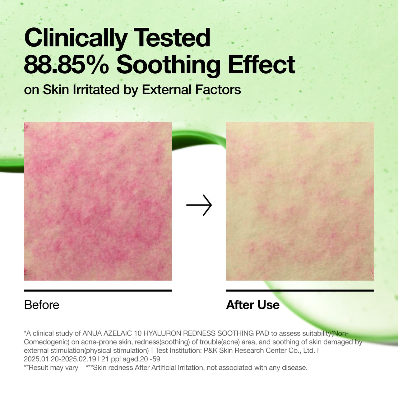 Anua Azelaic 10 Hyaluron Redness Soothing Toner Pads