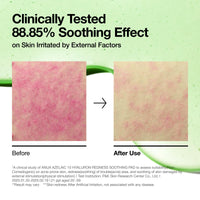 Thumbnail for Anua Azelaic 10 Hyaluron Redness Soothing Toner Pads