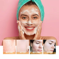 Thumbnail for 2 Pcs Turmeric  | Kojic Acid -Facial Cleanser