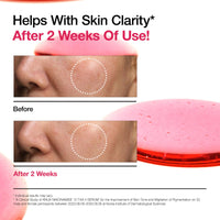 Thumbnail for ANUA Daily Sun Protection Serum Duo routine image