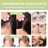 Thumbnail for HOYGI Cold Pressed Black Castor Oil for Hair Growth, 2 Pack