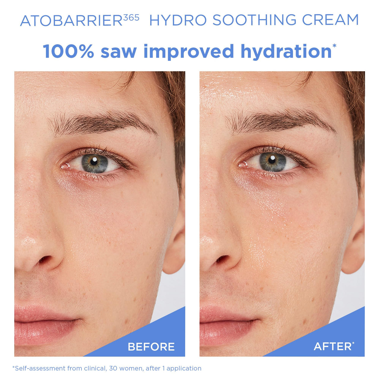 AESTURA ATOBARRIER365 Hydro Essence and Hydro Soothing Cream routine image