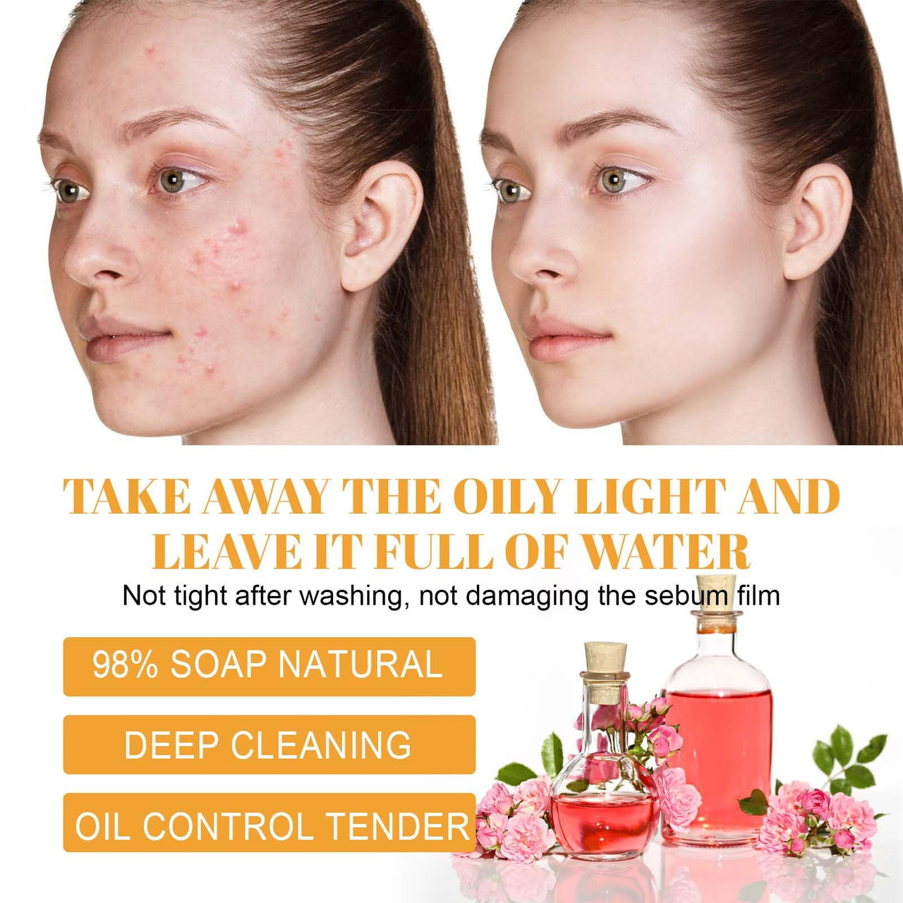 Before and after comparison of a woman's face with acne and clear skin, featuring skincare products and text about product benefits.